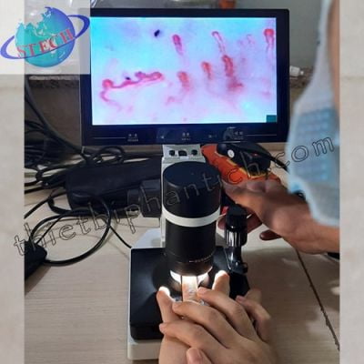 Kính hiển vi soi mạch máu SM-400X-10D (kèm màn hình 10 inch)